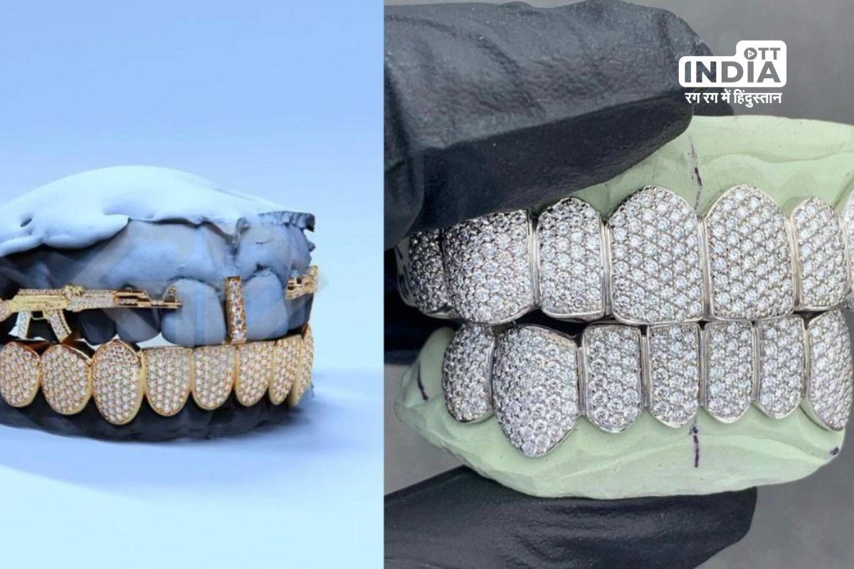 Navratri Diamond Craze: People in Surat Adorn Their Teeth with Sparkle – Heres the Cost