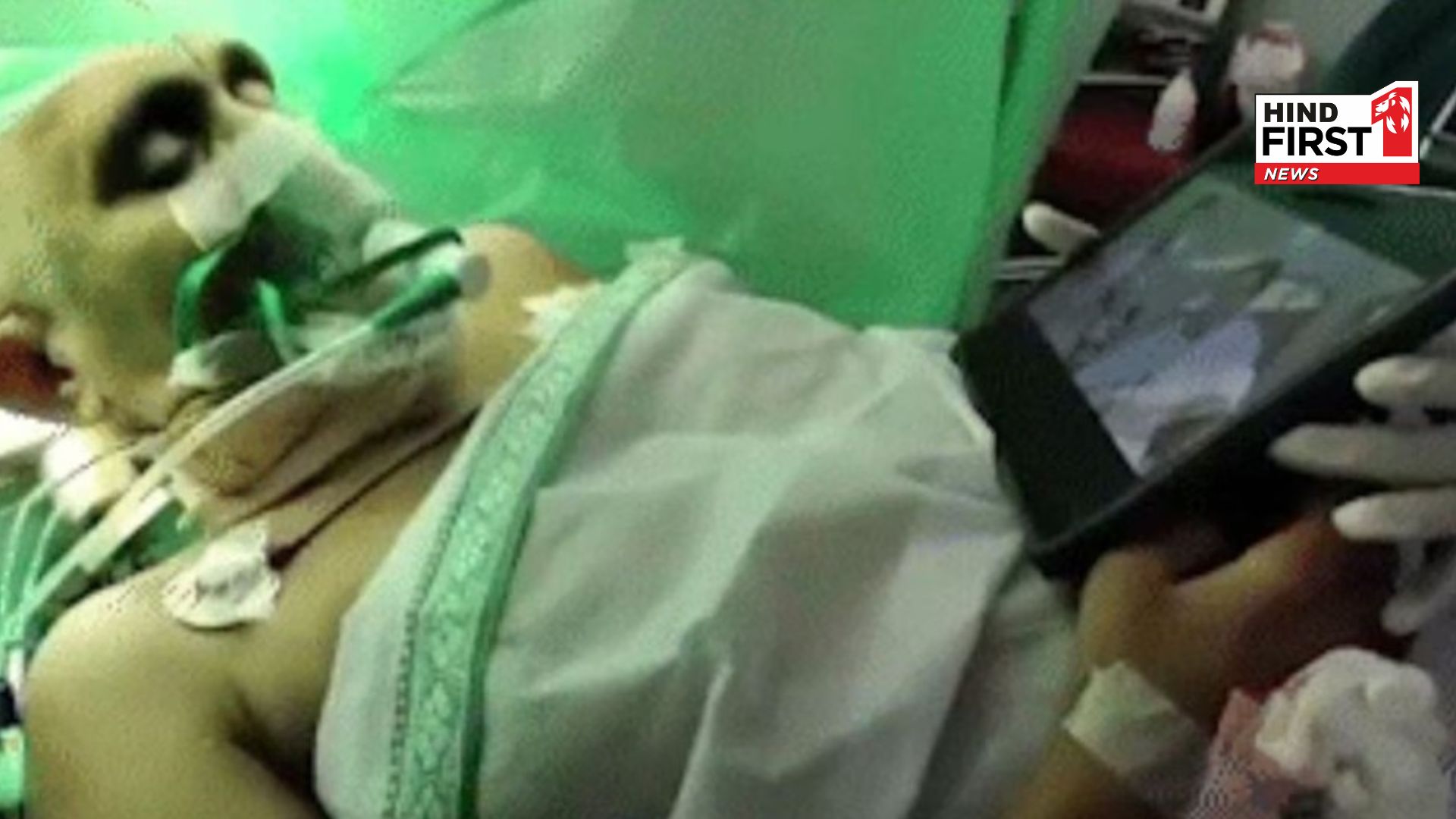 While in brain surgery, women watching Junior NTRs film, video viral on social media