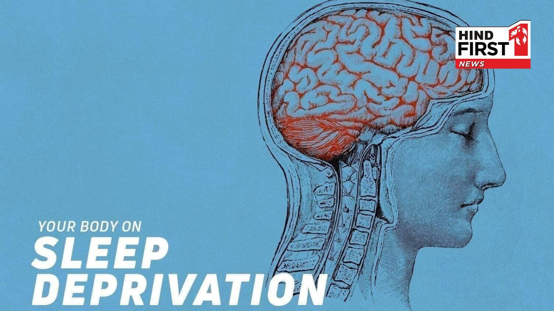 Effects of Sleep Deprivation on Your Body