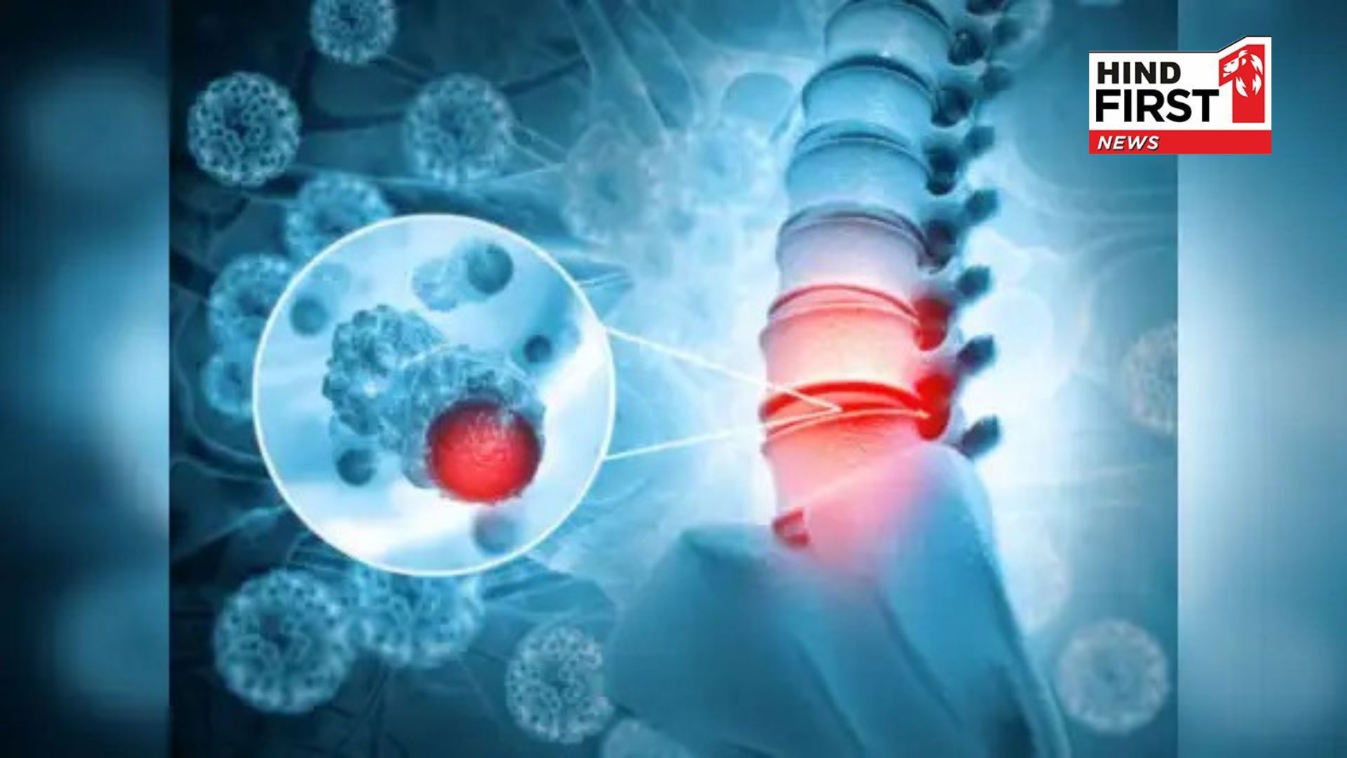 For bone strengthen eat these things daily after 30