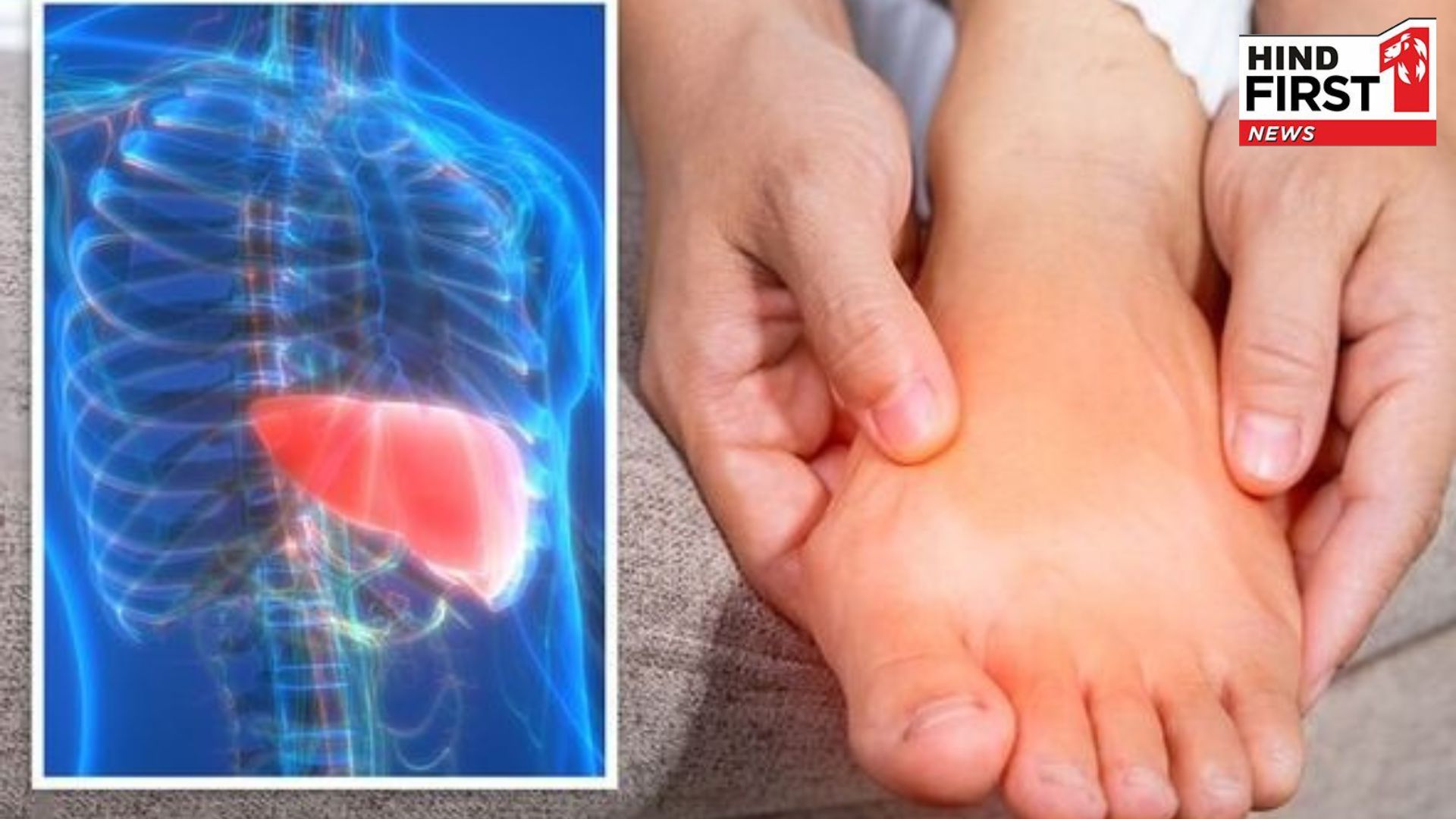 Fatty liver symptoms: These signs appear in the feet when the liver is damaged